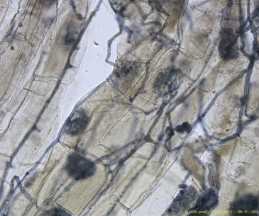 Les endomycorhizes d'oignons au microscope: les "amas" globuleux violets dans les cellules (les rectangles) des racines d'oignon